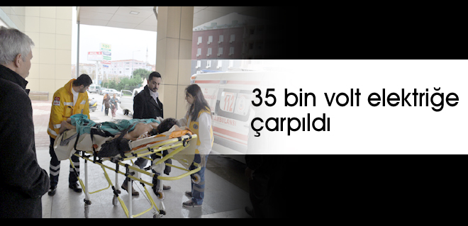 35 bin volt elektriğe çarpıldı