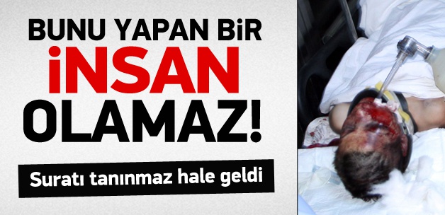 Sevgili dehşeti!