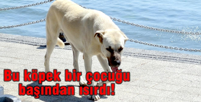 Bu köpek bir çocuğu başından ısırdı!