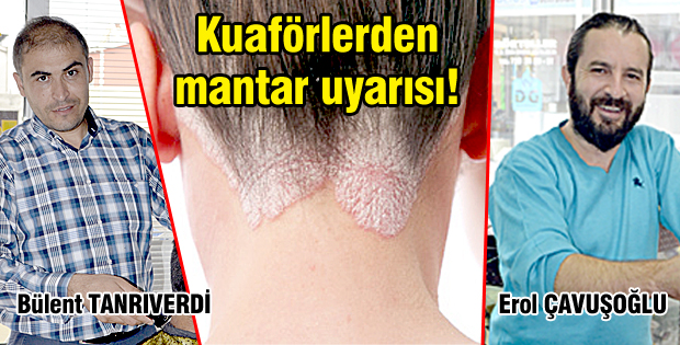 Kuaförlerden mantar uyarısı!