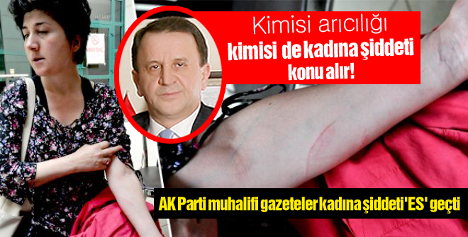 Işıklar, medyayı ikiye böldü