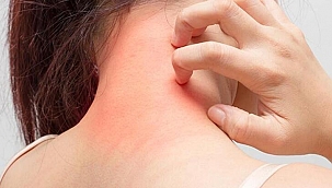 Ev karantinasında uyuz vakaları 2 buçuk kat arttı